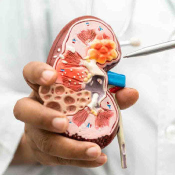 diabetic renal diseases treatment in Vijayawada